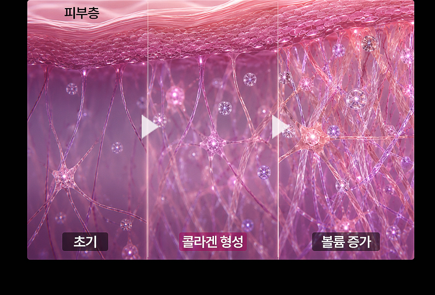 스컬트라 콜라겐 피부 탄력 개선