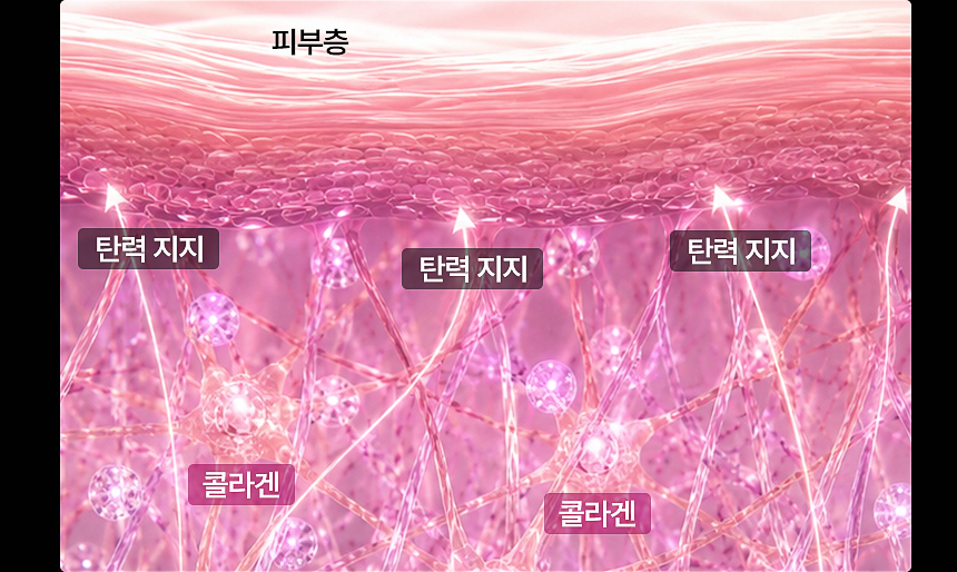 플로리아 스컬트라 시술 전후 변화