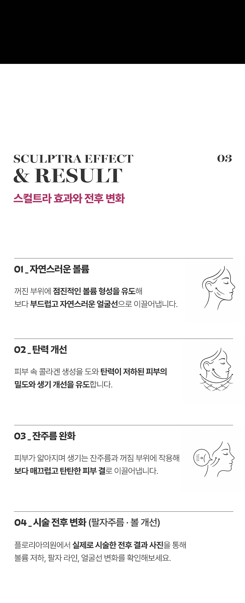 스컬트라 팔자주름 볼륨 얼굴선 개선