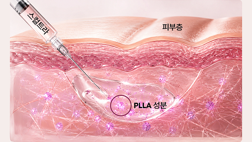 스컬트라 콜라겐 피부 탄력 지지 구조