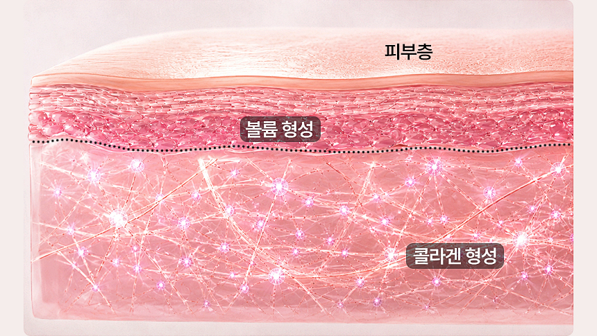 스컬트라 관자 눈밑 앞볼 옆볼 팔자주름 시술 부위
